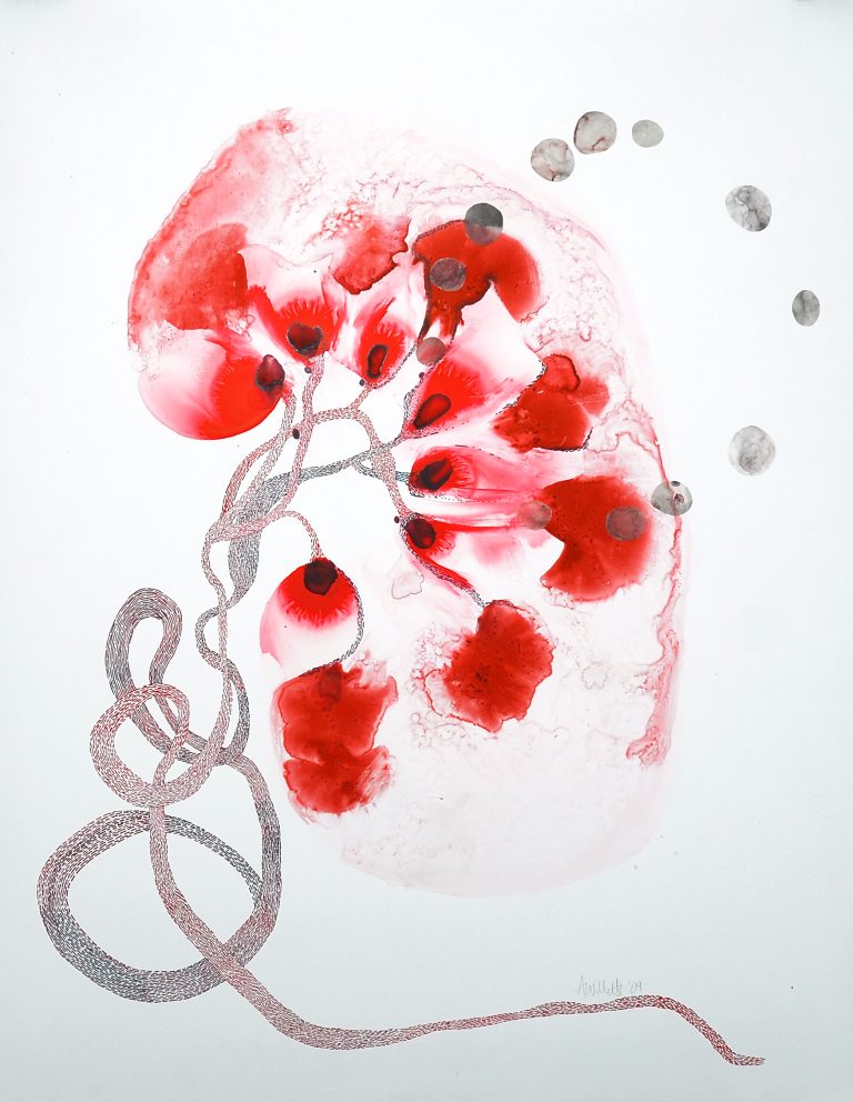 Lee más sobre el artículo PsicoTransplant